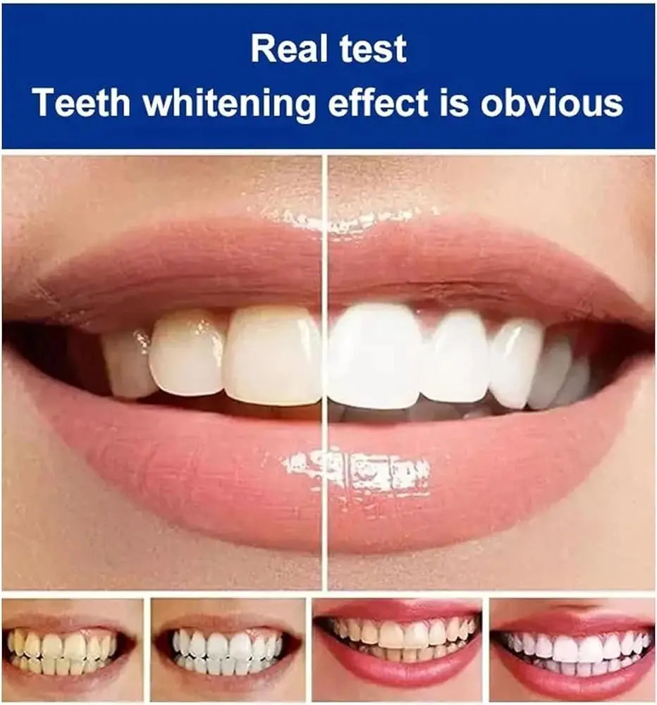 EELHOE SP-4 Ultra+ Teeth Whitening Serum – Professional Stain Removal for Yellow & Discolored Teeth Zaynora Beauty