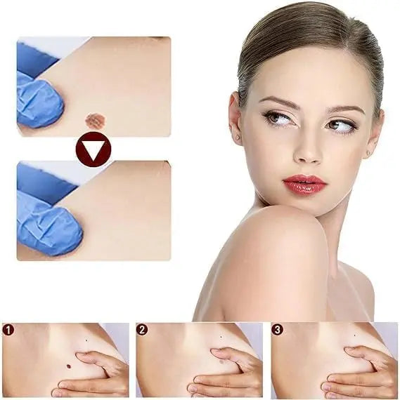 Liquid Wart Flat – Fast-Acting Topical Wart & Skin Tag Remover Beauty Hunt