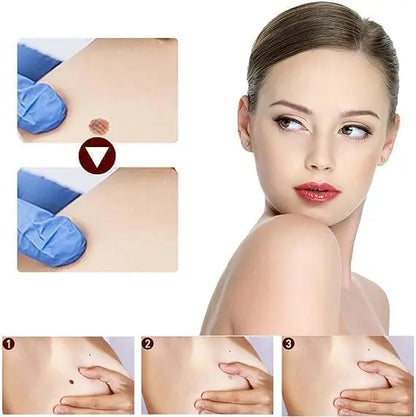 Liquid Wart Flat – Fast-Acting Topical Wart & Skin Tag Remover Beauty Hunt