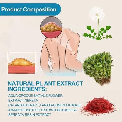 Lipoma Cyst Remover Cream – Topical Support for Reducing Lipomas & Skin Cysts Beauty Hunt