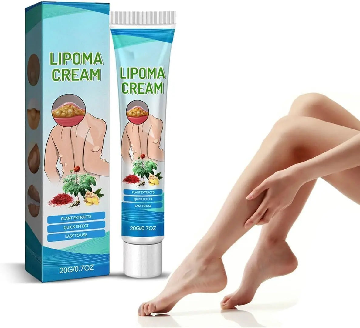 Lipoma Cyst Remover Cream – Topical Support for Reducing Lipomas & Skin Cysts Beauty Hunt