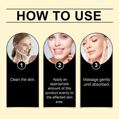 Ouhoe 7-Day Rapid Skin Repair Cream – Fast Recovery for Sensitive & Damaged Skin Beauty Hunt