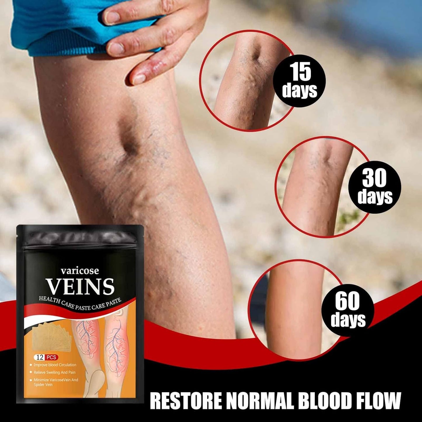 Hanel Varicose Veins Relief Patch – Natural Support for Leg Pain, Swelling & Spider Veins | Clinically Designed
