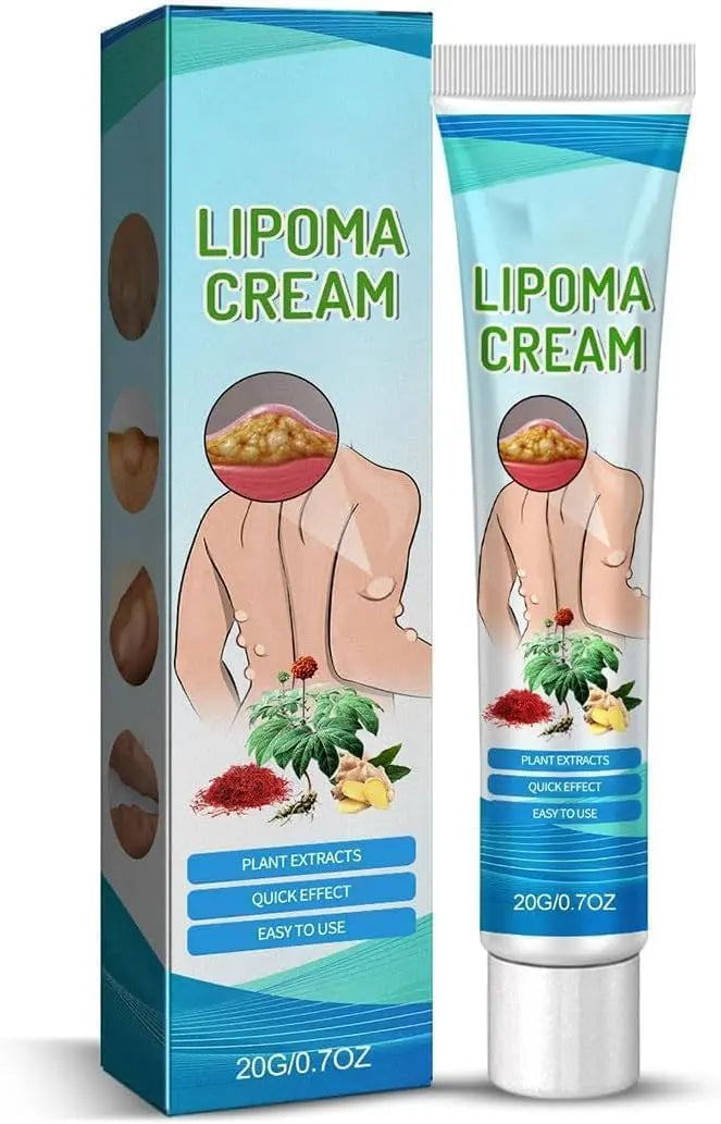 Lipoma Cyst Remover Cream – Topical Support for Reducing Lipomas & Skin Cysts Beauty Hunt