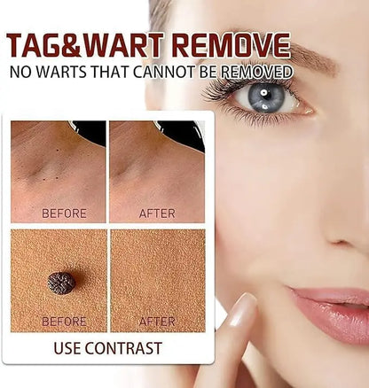Liquid Wart Flat – Fast-Acting Topical Wart & Skin Tag Remover Beauty Hunt