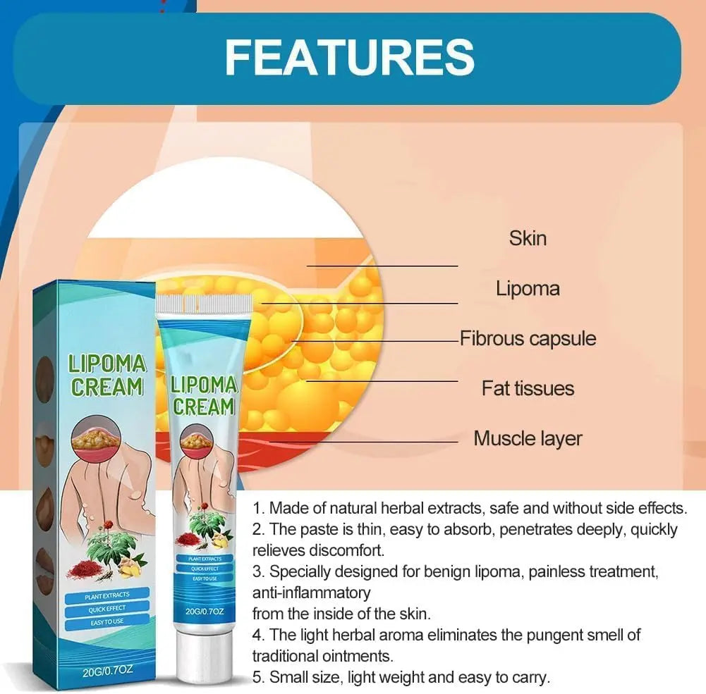 Lipoma Cyst Remover Cream – Topical Support for Reducing Lipomas & Skin Cysts Beauty Hunt