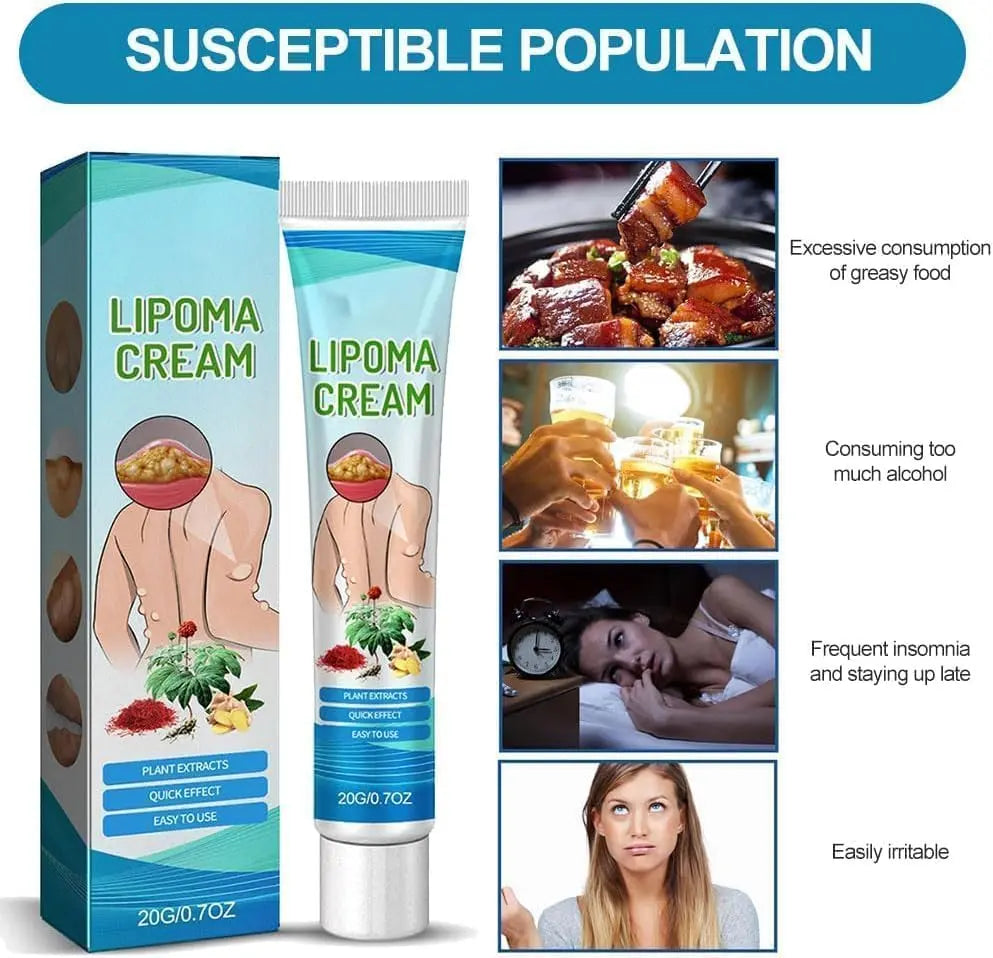 Lipoma Cyst Remover Cream – Topical Support for Reducing Lipomas & Skin Cysts Beauty Hunt