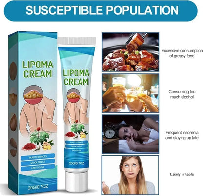 Lipoma Cyst Remover Cream – Topical Support for Reducing Lipomas & Skin Cysts Beauty Hunt