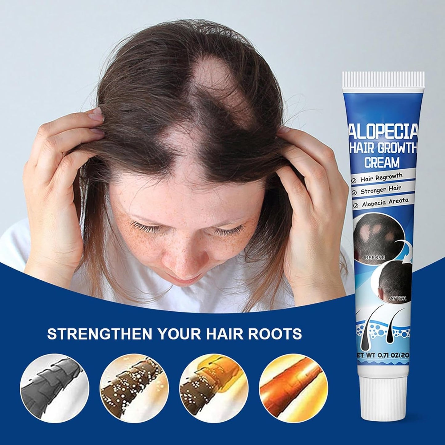 Sumifun Hair Growth Cream – Thickening & Regrowth Formula for Thinning Hair & Bald Spots
