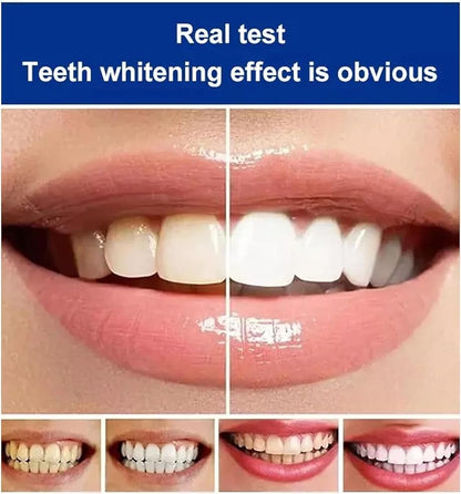 EELHOE SP-4 Ultra+ Teeth Whitening Serum – Professional Stain Removal for Yellow & Discolored Teeth