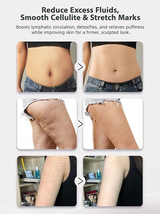 Lymphatic Drainage Massager Anti Cellulite Body Massage Tool