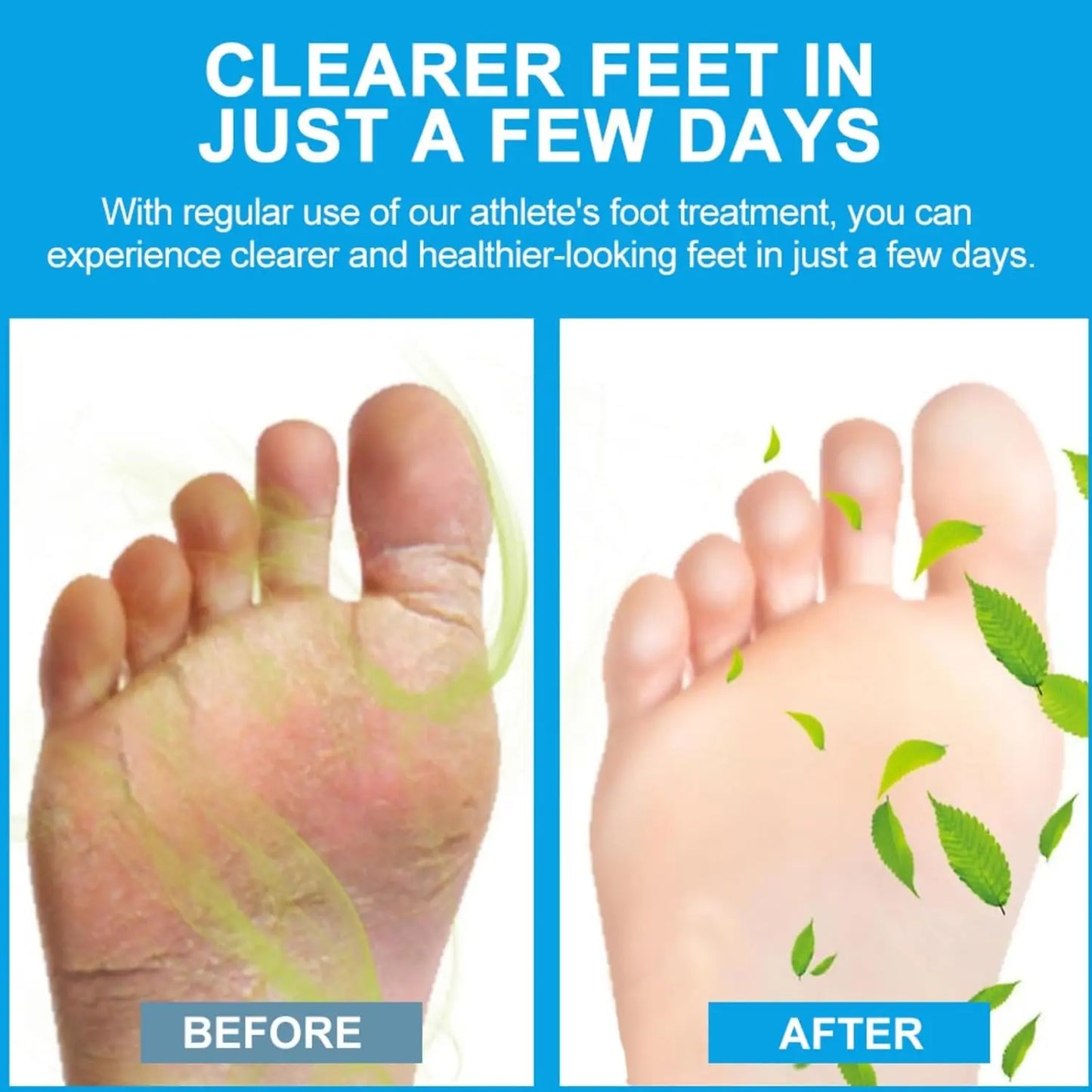 Sumifun Foot Anti-Bacterial Cream – Fights Odor & Fungus - Beauty Hunt