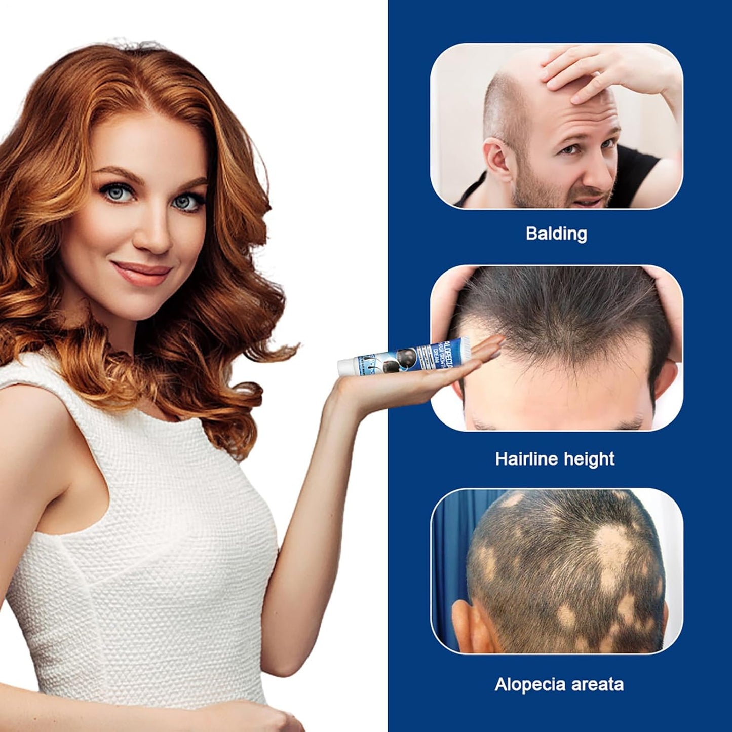 Sumifun Hair Growth Cream – Thickening & Regrowth Formula for Thinning Hair & Bald Spots