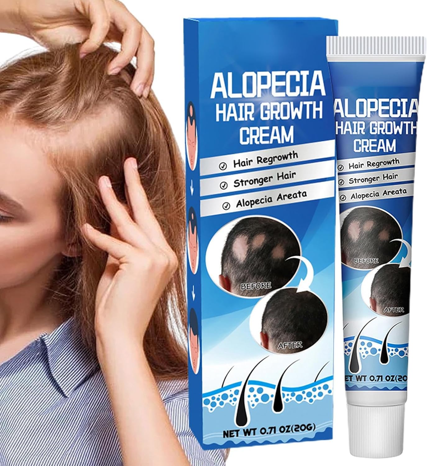 Sumifun Hair Growth Cream – Thickening & Regrowth Formula for Thinning Hair & Bald Spots