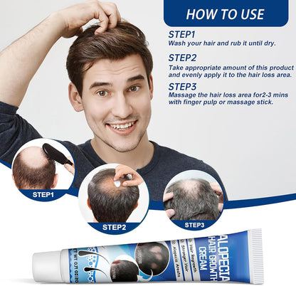 Sumifun Hair Growth Cream – Thickening & Regrowth Formula for Thinning Hair & Bald Spots