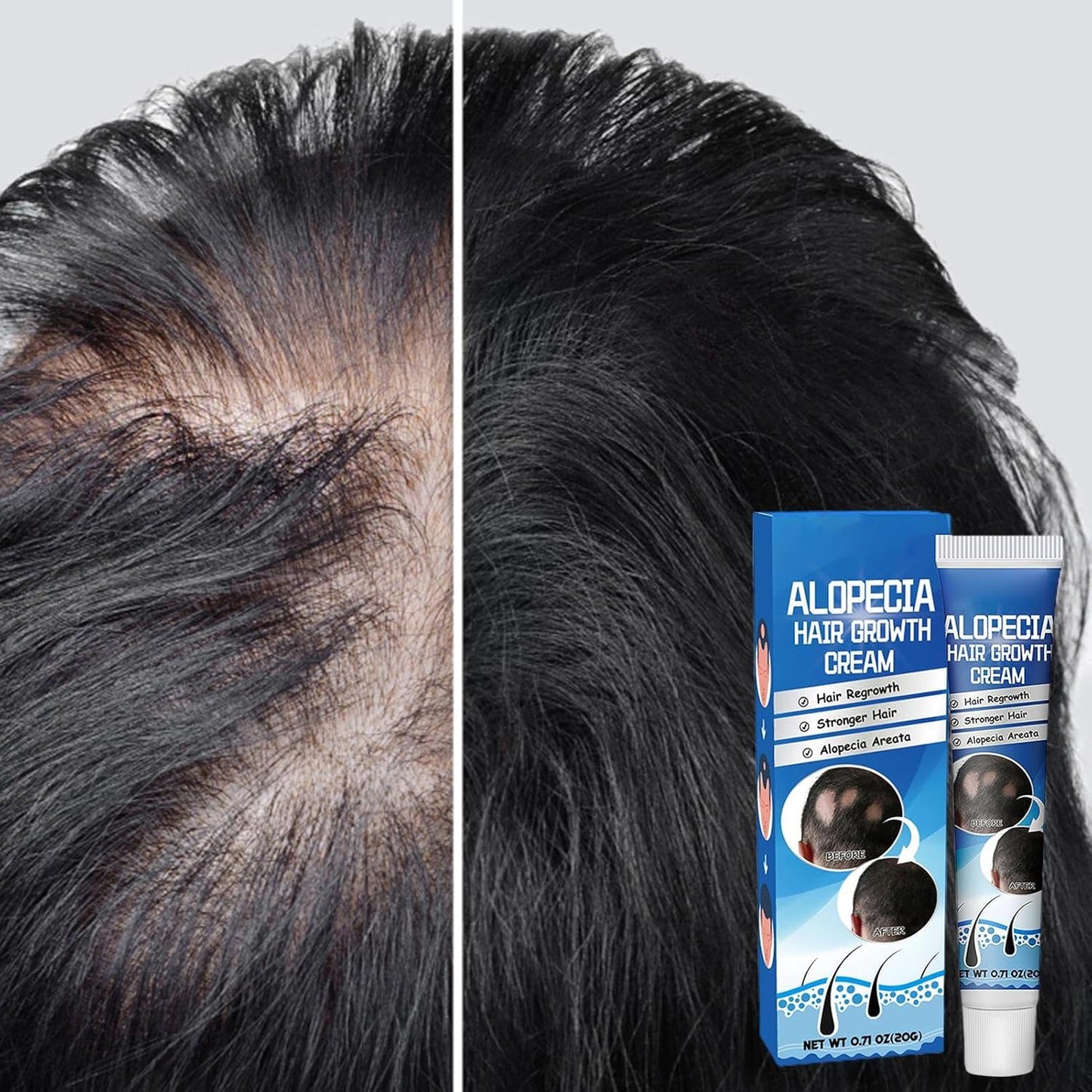 Sumifun Hair Growth Cream – Thickening & Regrowth Formula for Thinning Hair & Bald Spots