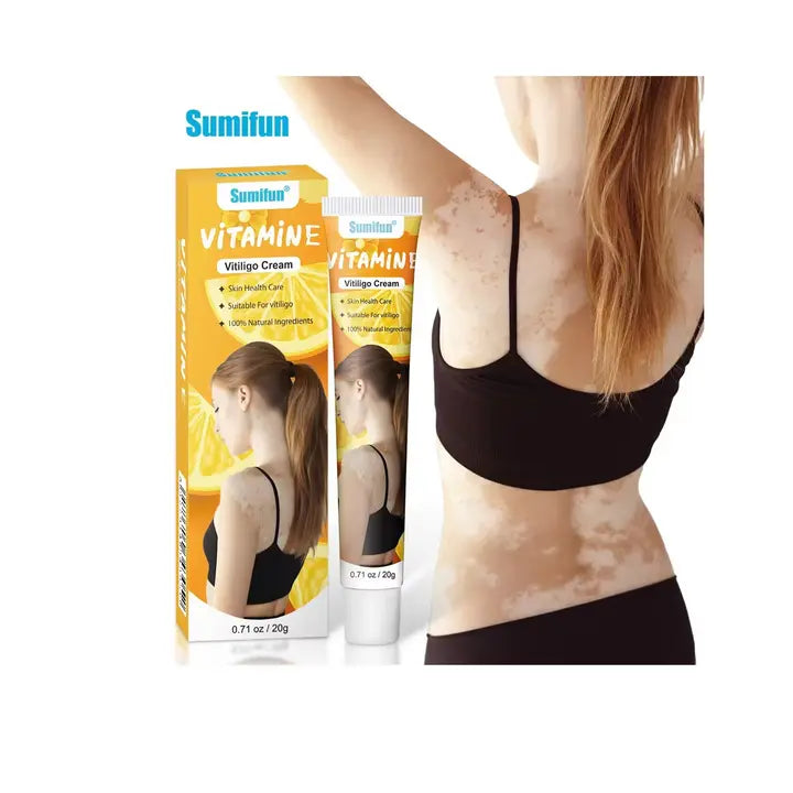 Sumifun Vitamine Vitiligo Cream – Herbal Vitamin-Enriched Repigmentation Support Beauty Hunt