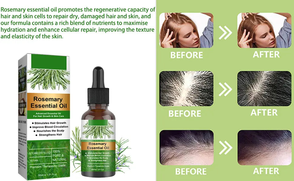 Rosemary Essential Oil for Hair Growth - Pure & Natural Hair Care Oil Beauty Hunt
