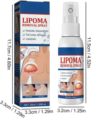South Moon Lipoma Removal Oil Spray - Natural Fatty Lump & Tumor Dissolving Treatment (50ml)
