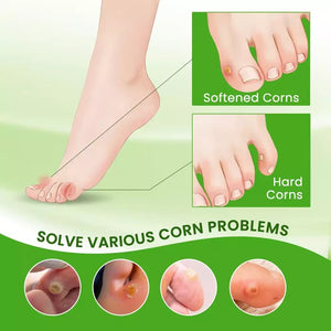 Sumifun Corn Removal Cream | Effective Foot Corn & Callus Remover