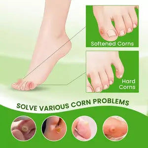 Sumifun Corn Removal Cream | Effective Foot Corn & Callus Remover Beauty Hunt